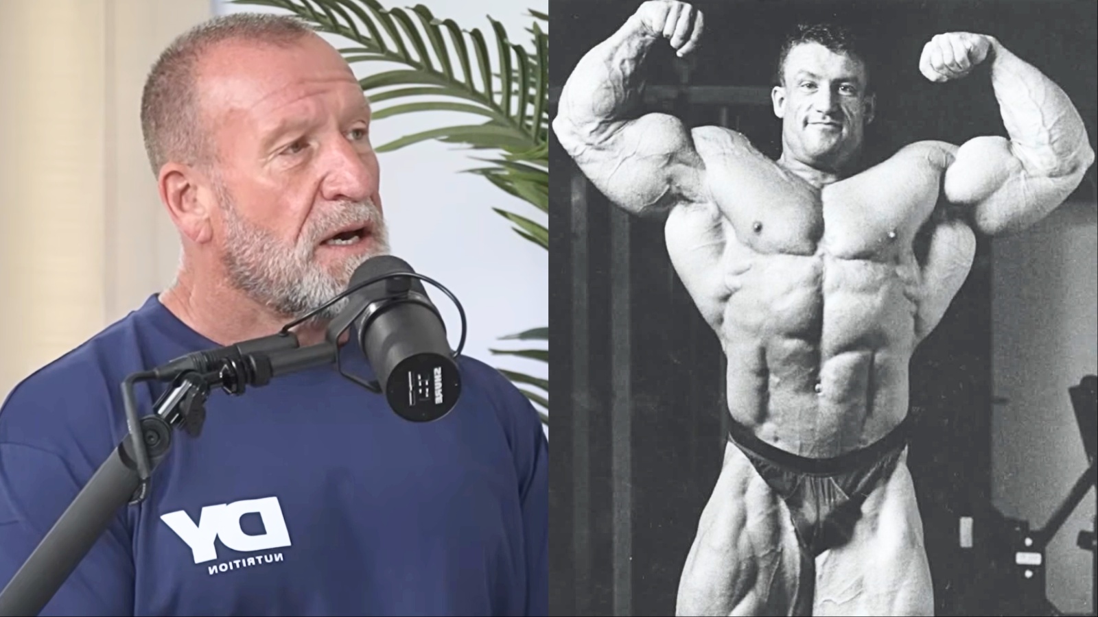 Um corpo muscular com músculos definidos e óleo de Synthol infiltrado em áreas específicas, destacando a distorção artificial